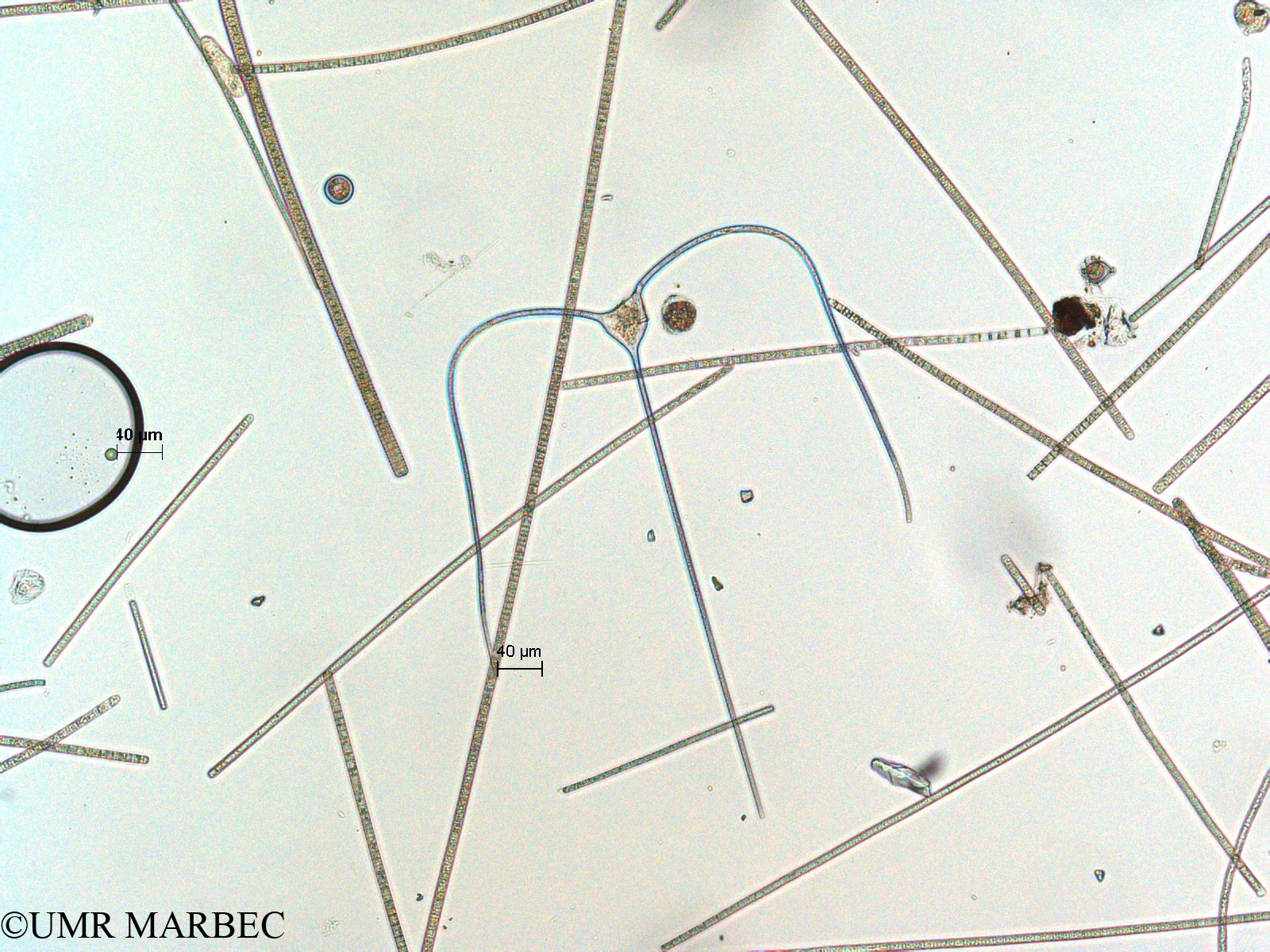 phyto/Scattered_Islands/all/COMMA April 2011/Tripos trichoceros (ancien Neoceratium trichoceros -N. sp1-2)(copy).jpg